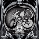 МРТ органів черевної порожнини