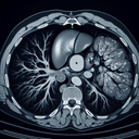 МРТ селезінки